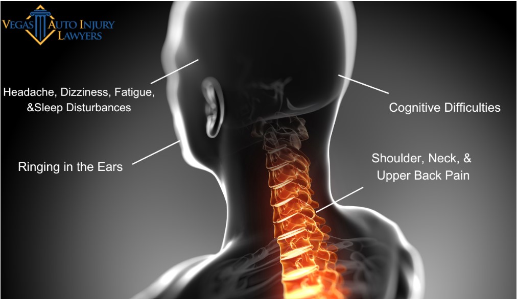 Diagram of the rear view of a human head, neck and shoulders with possible symptoms of whiplash after a car accident produced by Vegas Auto Injury Lawyers.